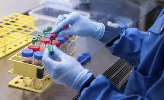 Cả thế giới đang chờ đợi vắc-xin phòng COVID -19 được đưa vào cuộc sống 