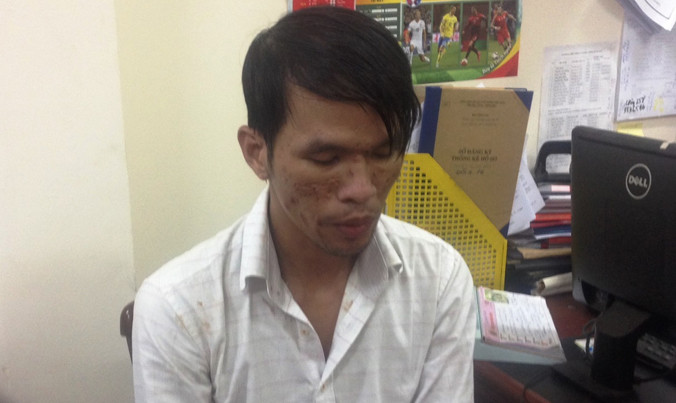 Nghi can Dũng bị công an tạm giữ để phục vụ điều tra. Ảnh: CA