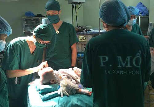 Ca mổ kéo dài 5 tiếng sửa lại hộp sọ cho bệnh nhi. Ảnh: Bệnh viện cung cấp. 