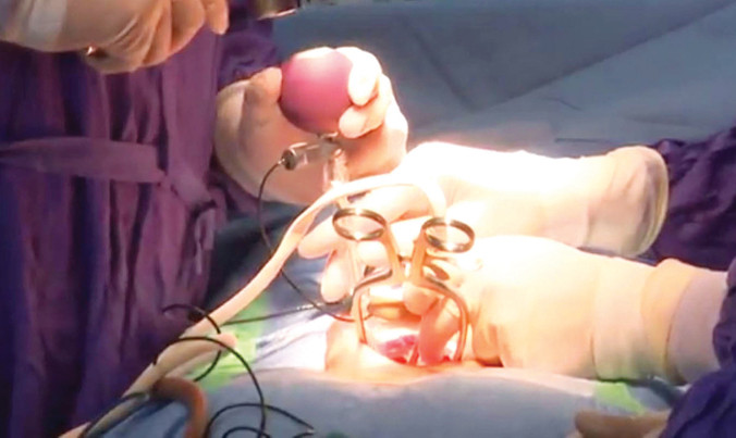 Các bác sĩ phẫu thuật dưới sự giám sát của hệ thống cảnh báo