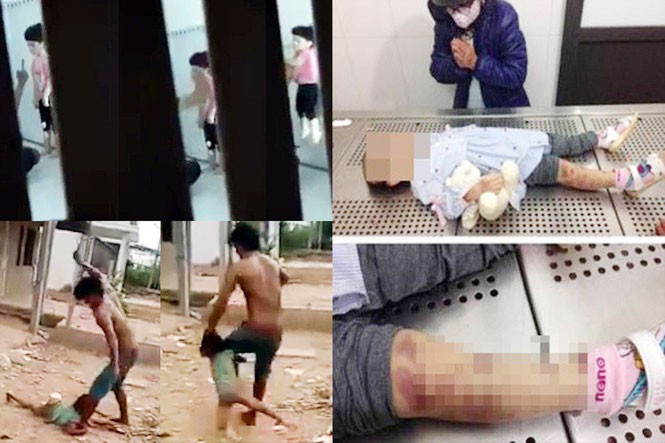 Nhiều trường hợp trẻ em bị bạo hành xảy ra trong thời gian vừa qua