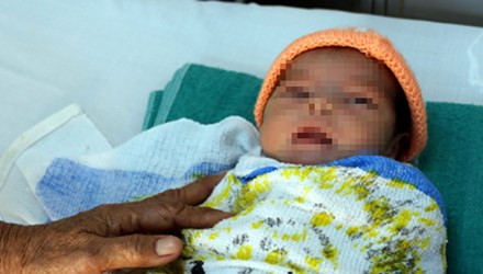 Bé gái đã hồi phục sức khỏe. Ảnh: Vnexpress