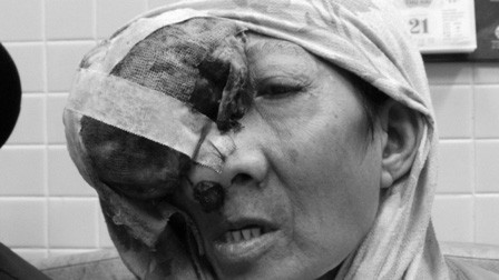 Bệnh nhân trong tình trạng đau đớn, sợ hãi