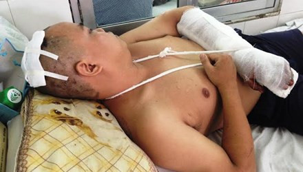 Nạn nhân Phạm Văn Mạnh bị chém vỡ xương sọ, đứt gân tay đang điều trị tại bệnh viện