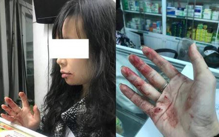 Hình ảnh chị Diệu L. sau khi bị đánh.