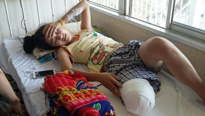 Cháu Vi trên giường bệnh tại BV Chợ Rẫy.