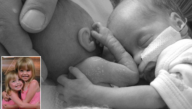 Kỳ lạ cô bé sinh ra chỉ dài bằng chiếc bút bi