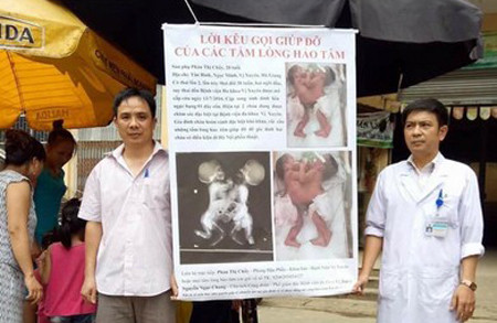 Các bác sĩ Bệnh viện Đa khoa huyện Vị Xuyên Hà Giang ra chợ kêu gọi giúp đỡ cặp song sinh dính liền. Người mặc áo blouse là bác sĩ Nguyễn Ngọc Chung.