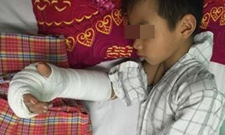 Cháu T.D.L. Ảnh: Sức khỏe đời sống. 