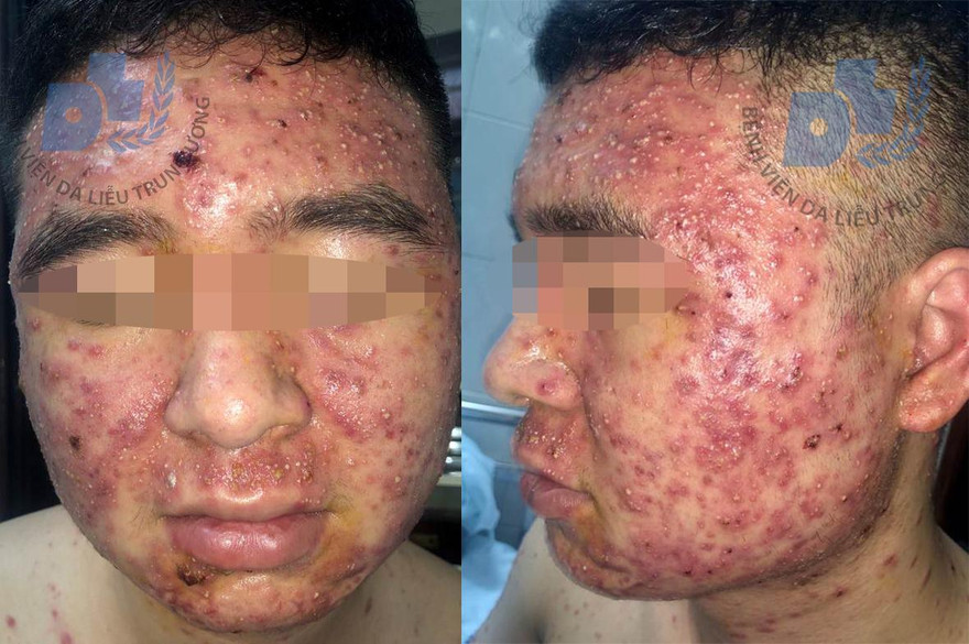 Nạn nhân của mỹ phẩm giả mua trên mạng