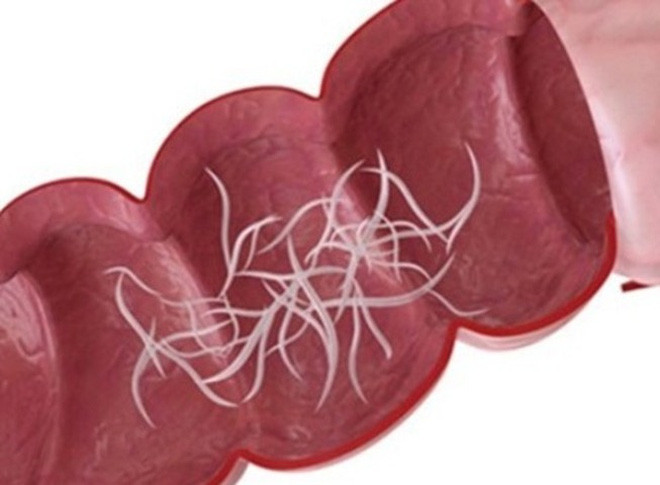 Ảnh minh họa: Internet