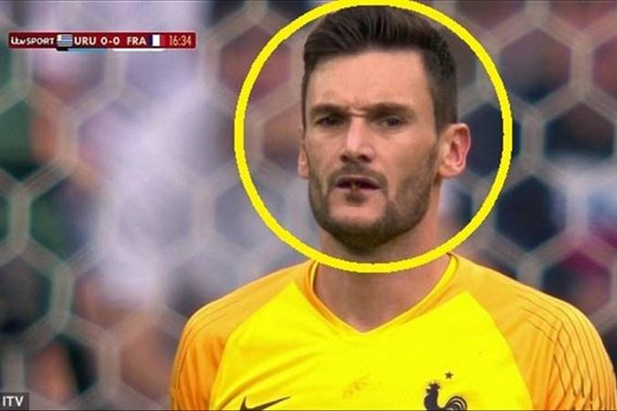 Thủ môn tuyển Pháp suýt nuốt phải côn trùng khi đấu Uruguay