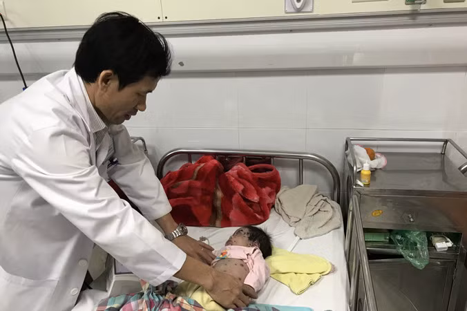 Bác sĩ Đỗ Thiện Hải khám cho bệnh nhi G.B. Ảnh: T.Hà.