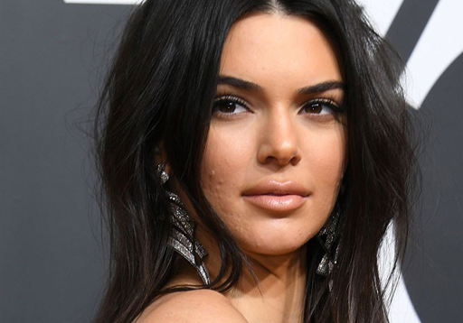 Kendall Jenner với khuôn mặt mụn tạo nên cả một trend “không thèm che khuyết điểm”.
