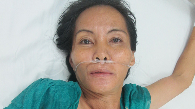 Bà Vân nằm trong bệnh viện. Ảnh: Hòa Hội