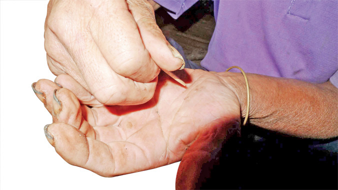 Vị trí chích trên bàn tay, nếu máu chảy chứng tỏ người đó có tội