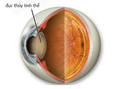 Ảnh minh họa: Internet 