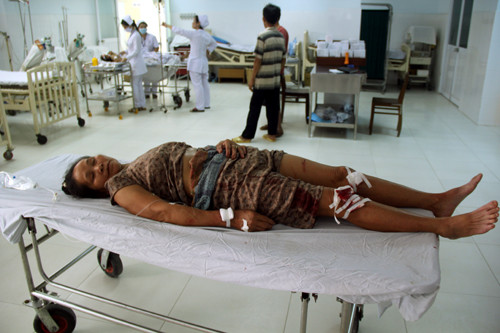 Một trong số các nạn nhân đang điều trị tại bệnh viện. Ảnh: Vnexpress.