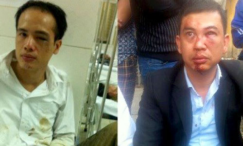 Hai luật sư Luân (trái) và Nam sau khi bị hành hung.