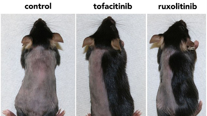 Sắp có thuốc trị hói?