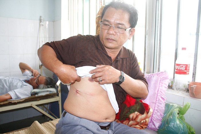 Ông Hồ Tăng, phó trưởng công an xã Tâm Xuân 1 và vết thương ở hông đang chữa trị tại BV Đa khoa Quảng Nam 