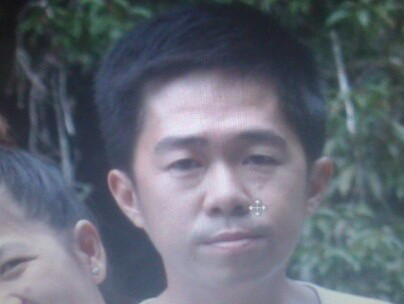 Cô gái vật vã đau đớn vì bị người yêu tạt axit