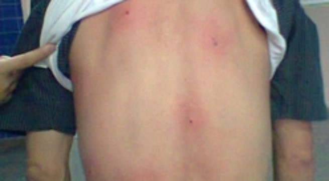 Ảnh mang tính minh họa