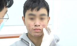 'Hàng hiệu' giá bèo từ chợ đến mạng - bài 2: Phía sau lời quảng cáo 'trắng cấp tốc'