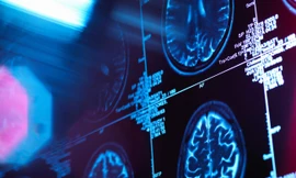  Các nhà nghiên cứu đã phân tích ảnh chụp MRI của 10.000 người trẻ ở Mỹ