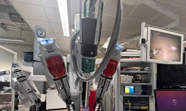 Cánh tay robot thực hiện phẫu thuật với độ chính xác 100%.