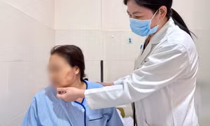 Suýt mất mạng vì giác hơi để... thải độc