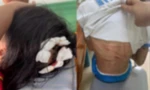 Công an vào cuộc vụ nữ sinh lớp 5 nghi bị cha dượng bạo hành