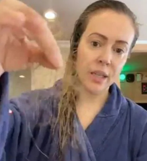Diễn viên Alyssa Milano cho biết, cô bị rụng tóc nhiều tháng liền do COVID-19. Ảnh: Twitter. Khỏi COVID-19, cô gái phải đánh răng suốt ngày vì “cứ nếm thấy vị virus” trong miệng ảnh 3