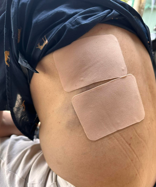 Tấn Beo đắp thuốc dán, đi đứng khó khăn sau khi bị ngã cầu thang. Tấn Beo đắp thuốc dán, đi đứng khó khăn sau khi bị ngã cầu thang.