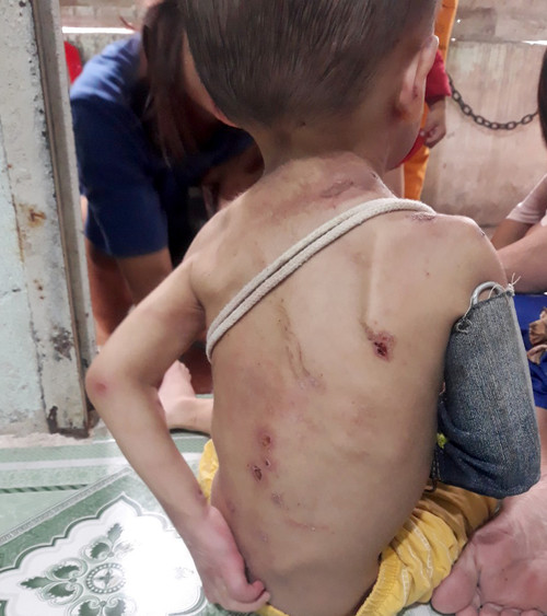 Vết thương trên vùng lưng của bé trai. Ảnh người dân cung cấp. Vết thương trên vùng lưng của bé trai. Ảnh người dân cung cấp.