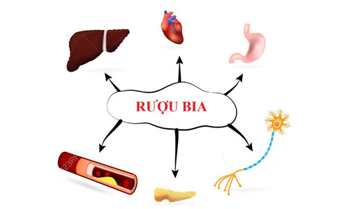 Bia rượu là nguyên nhân hàng đầu gây ra các bệnh về gan ở Việt Nam