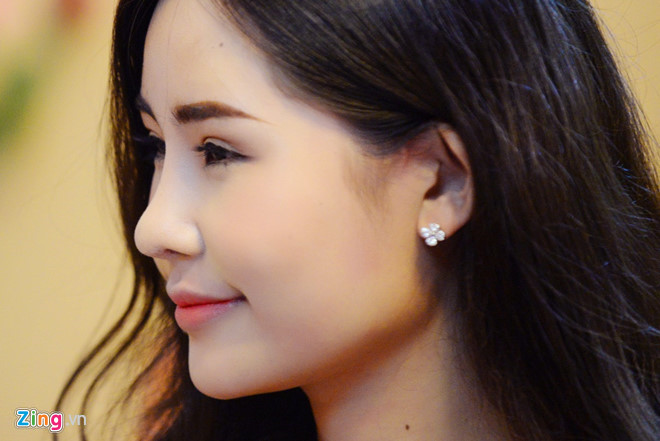 Tân hoa hậu Đại Dương thừa nhận mình từng nâng mũi, sau đó đã tháo đệm. Ảnh: Thanh Tùng