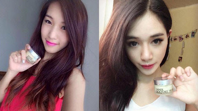 Sau 3 tuần hết sạch nám da, tàn nhang, sạm da, đốm nâu