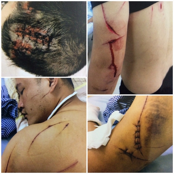 Hải Phòng: 'cát tặc' chém trọng thương chủ đầm tôm vì dám ngăn cản