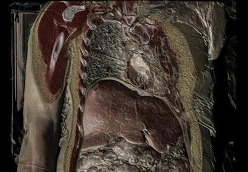 Mụn nhọt, nám da, mệt mỏi – tuyệt đối đừng coi thường