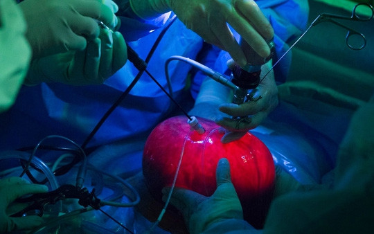 Tử cung người mẹ được tạm lấy ra, bơm căng, chiếu sáng, trong khi các bác sĩ dùng dụng cụ nội soi để gây mê và phẫu thuật cho em bé bên trong - Ảnh do nhóm nghiên cứu cung cấp.