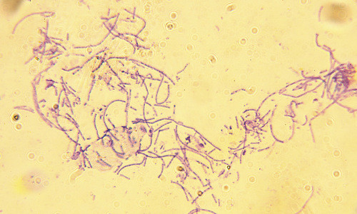 Vi khuẩn bệnh than có hình que dài. Ảnh: Live Science.