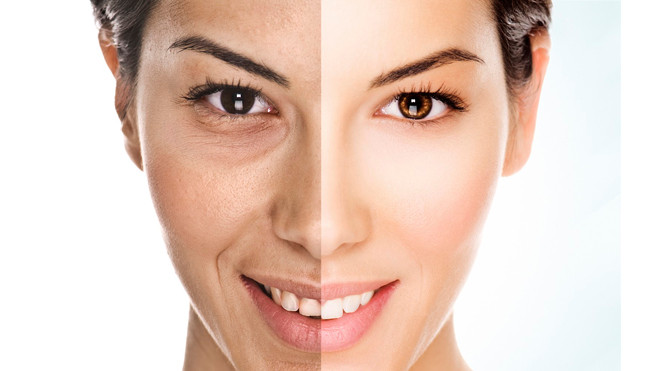 Hút thuốc lá làm tăng nguy cơ xuất hiện nếp nhăn