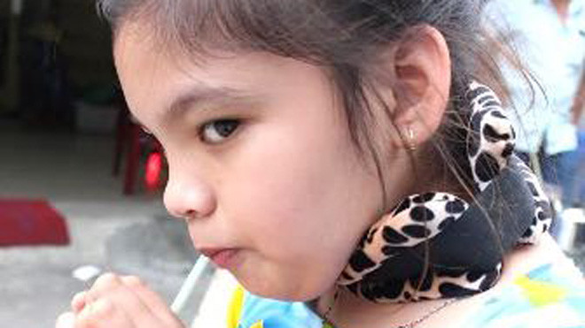 Bé Thanh Tuyền lần đầu tiên có thể tự tay cầm cốc uống nước sau khi ghép tế bào gốc tại Bệnh viện Đa khoa Quốc tế Vinmec Times City.