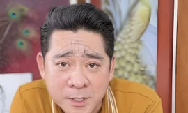 Diễn viên Huỳnh Anh Tuấn cảnh báo 