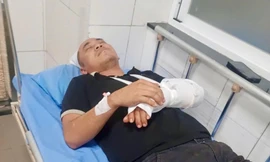 Nhân viên cứu hộ giao thông ở Lâm Đồng bị đánh gãy tay trên cao tốc