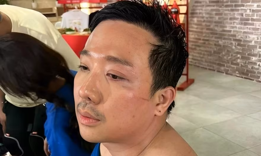 Trấn Thành chỉ ngủ 12 phút/ngày
