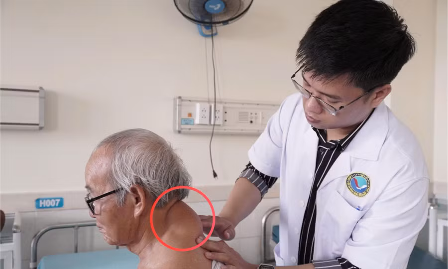 Đà Nẵng: Cụ ông 'mang' khối u ở gáy suốt 40 năm