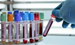 Lật ngược chẩn đoán viêm tụy nhờ phát hiện enzyme khổng lồ: Bất ngờ từ 1 ca bệnh hiếm gặp 