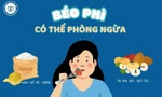 Béo phì chính thức được coi là bệnh mạn tính